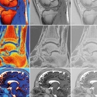 Najnowsze możliwości diagnostyki obrazowej w zakresie badań Rezonansu Magnetycznego 