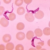 Parasitic Infection 2016