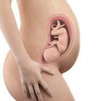 Pregnancy and Childbirth 2016