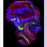 Molecular Biology of Hearing & Deafness