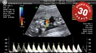  Praktyczna ultrasonografia w codziennej praktyce ginekologa-położnika