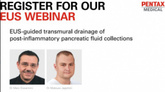 EUS-guided transmural drainage of post-inflammatory pancreatic fluid collections