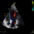 echo cardiographie