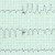 Akademia EKG