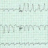 Akademia EKG