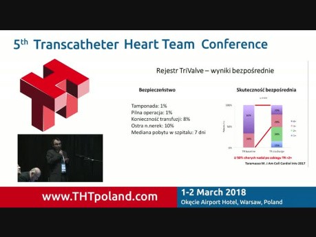 Przezcewnikowe leczenie wad zastawki trójdzielnej