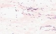 Substancja międzykomórkowa tkanki łącznej - histologia