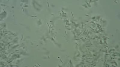 Lactobacillus acidophilus