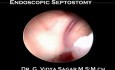 Endoskopowa septostomia