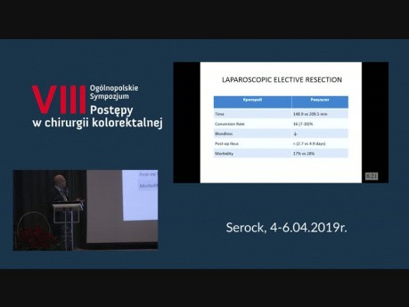 Procedure Standarization in Elective Resection for Diverticular Disease