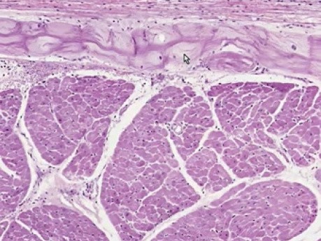 Serce - włókna Purkinjego - histologia