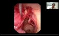 Endoskopowa anatomia ucha