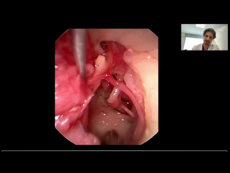 Endoskopowa anatomia ucha