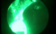 Laser Greenlight - naprawdę zielony