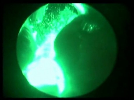Laser Greenlight - naprawdę zielony