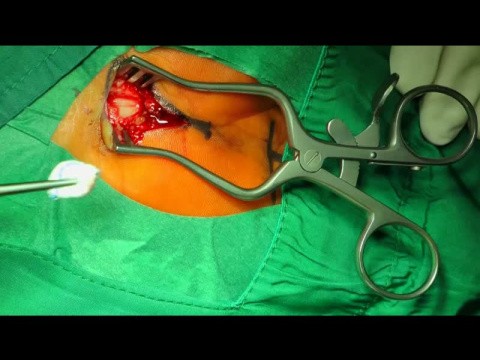 Hand & Upper Limb