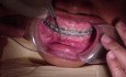 Pacjent Ortodontyczny RM - 7 miesięcy