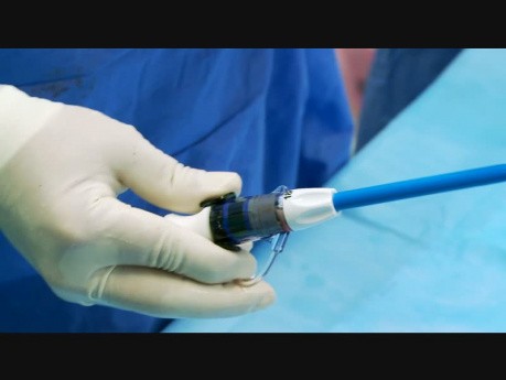 Transaortalna implantacja zastawki (TAVI)