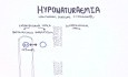 Hiponatremia - klasyfikacja, przyczyny, patofizjologia, postępowanie