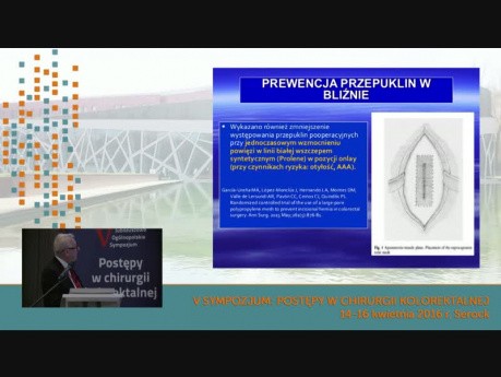 Nowoczesne leczenie przepuklin pooperacyjnych w chirurgii kolorektalnej połączone z rekonstrukcją powłok przedniej ściany jamy brzusznej – prof. Andrzej Matyja