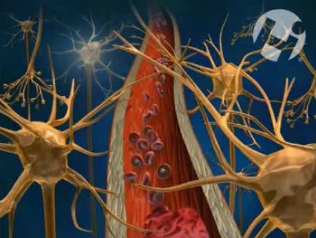 Żylny dopływ krwi do mózgu