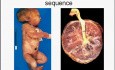 Choroby wieku niemowlęcego i dziecięcego - patomorfologia - część 10b