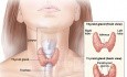 Technika całkowitej tyreoidektomii (11 kroków)