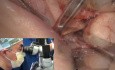 Mikroskop jako interdyscyplinarne urządzenie - chirurgia jamy ustnej