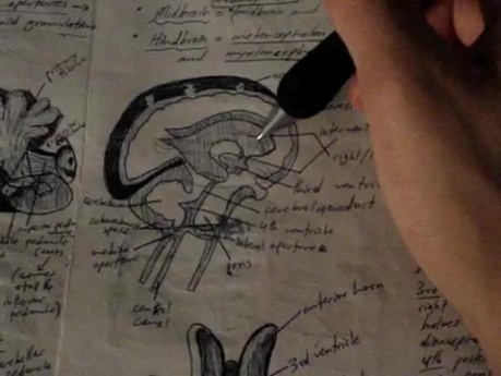 Móżdżek i komory -  neuroanatomia - samouczek - 19