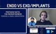 Endodoncja vs implanty – z Omarem Ikram