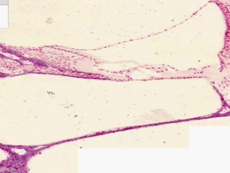 Ucho wewnętrzne - 1 - histologia