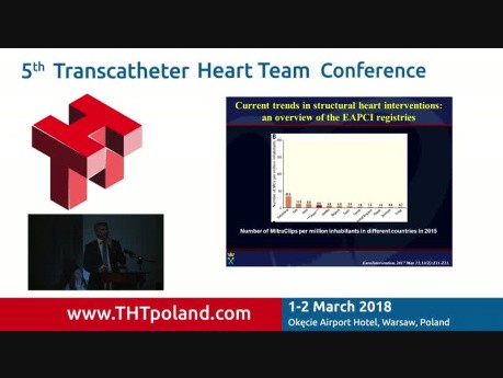 Przezcewnikowe leczenie wad zastawki mitralnej w Polsce