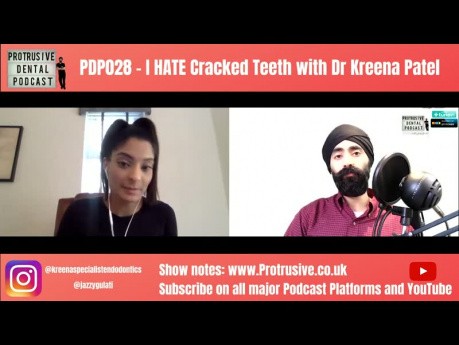 Pęknięcia zębów - podcast z dr Kreena Patel