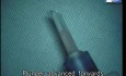 Endoshield DSEK Graft Injector - wideo