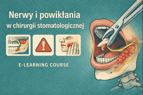Nerwy i powikłania w chirurgii stomatologicznej