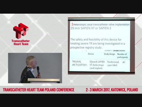 Transcatheter Triscupid Valve Repair in 2017: Device Overview and Clinical Outcomes