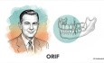 Geneza osteosyntezy wyrostka kłykciowego żuchwy.