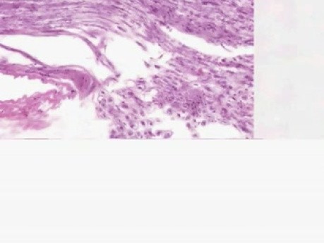 Nerw - histologia