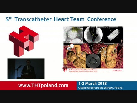 TAVI in Pure Native Aortic Valve Regurgitation