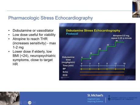 Echokardiografia stresowa i ocena choroby wieńcowej