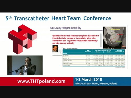 How to Analyze the Mitral Valve before Transcatheter Replacement in CT