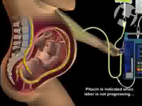Pitocin - wpływ na skurcze macicy