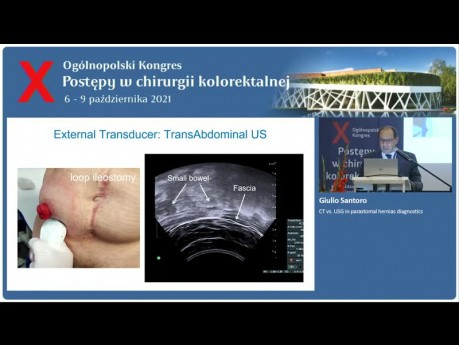 CT vs. Ultrasound in Parastomal Hernia Diagnostics