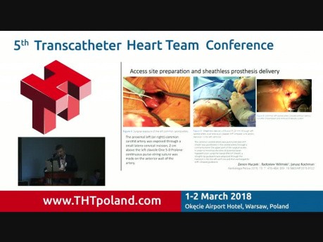 Transcarotid access for TAVI