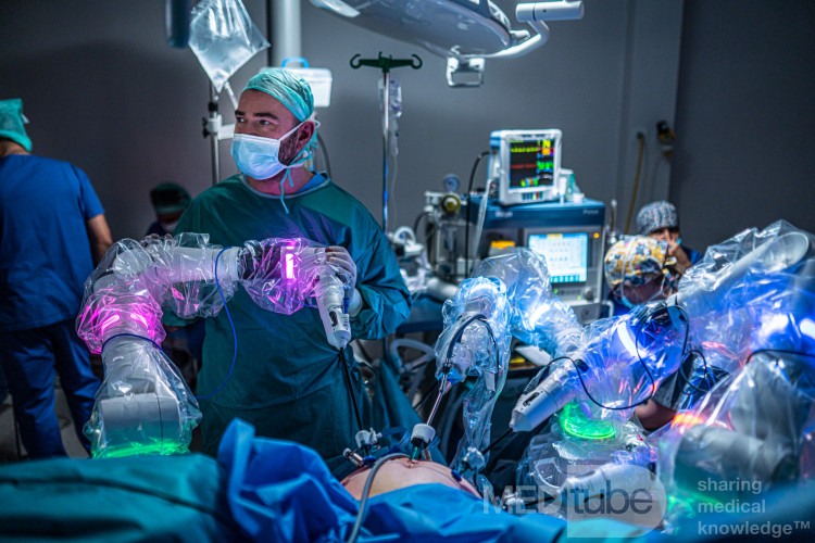 Versius in Clinical Use in Urology at Salve Medica Medical Centre, Łódź – BSU Arm