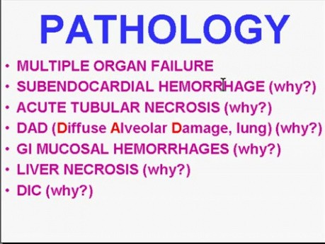 Zaburzenia hemodynamiczne, choroba zakrzepowo-zatorowa i wstrząsy - patomorfologia - część 4k