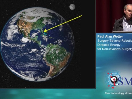 Chirurgia wykraczająca poza robotykę: energia ukierunkowana na chirurgię nieinwazyjną - SMIT 2019