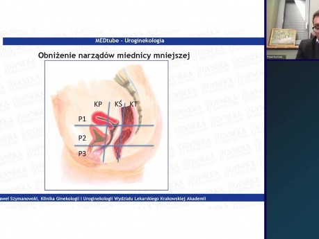 Diagnostyka obniżenia narządów miednicy mniejszej - część 5