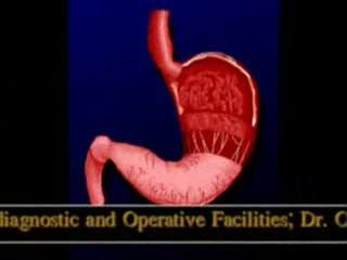Wideogastroskopia- prezentacja ośrodka wykonującego m.in. endoskopie przewodu pokarmowego