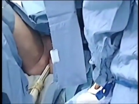 Biopsja prostaty z użyciem USG transrektalnego